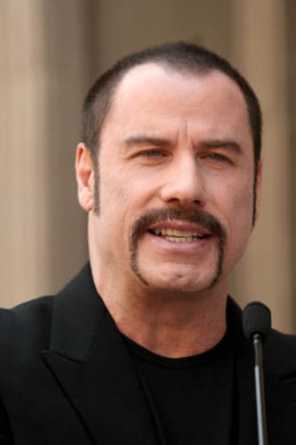 John Travolta's receding hairline
