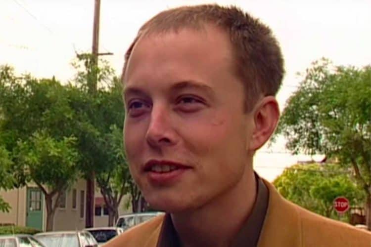 Elon Musk Balding Hair
