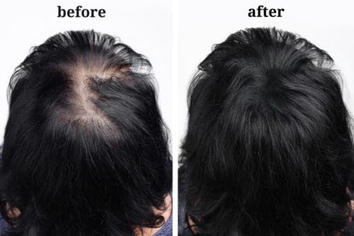 bald spot spray concealer with hair fibers