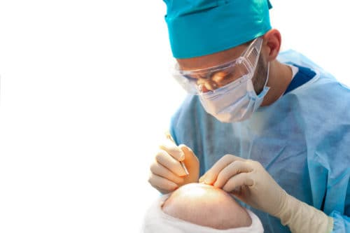 Doctor performing hair transplant Doctor working on a hair transplant patient.