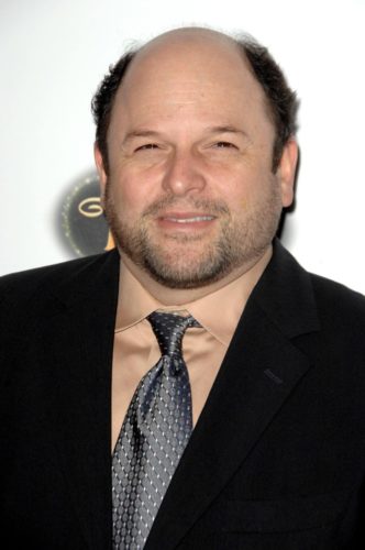 Jason Alexander with a horseshoe shaped hairline Jason Alexander with a horseshoe shaped hairline.