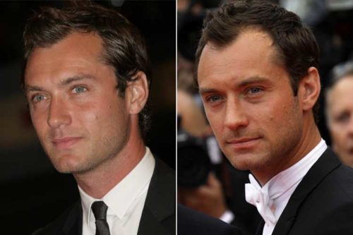 receding Jude Law hairline Receding Jude Law hairline