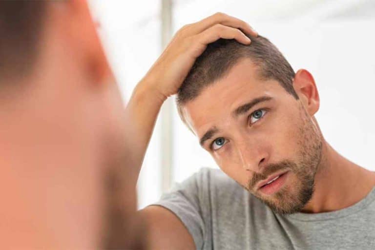 Determine your Stage of Hair Loss on the Norwood Scale
