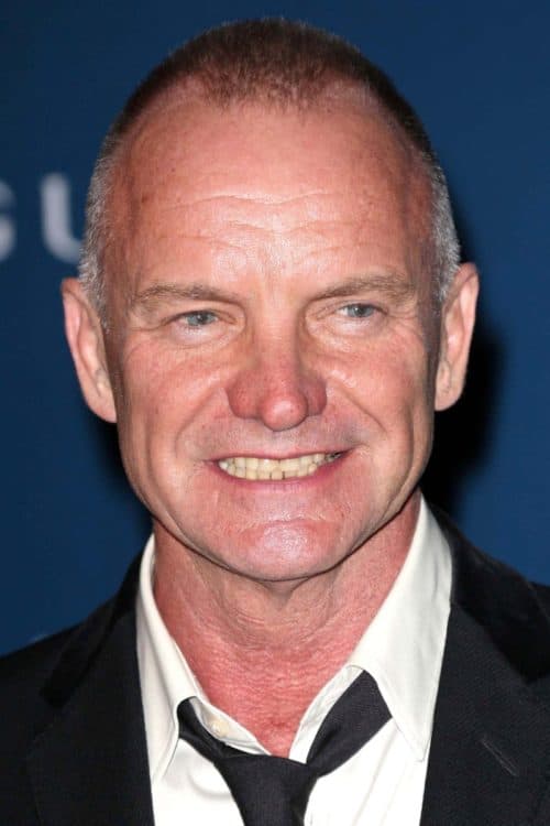 Sting's with a deep recede in his hairline with a buzz cut.