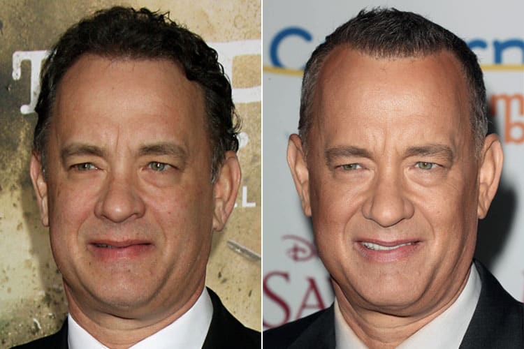 Tom Hanks side by side mature hairline